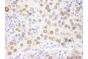 Immunohistochemistry (IHC) image for anti-High Mobility Group Nucleosome Binding Domain 1 (HMGN1) (AA 90-100) antibody (ABIN7448975) (HMGN1 anticorps  (AA 90-100))