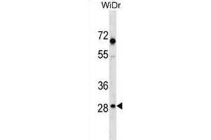 Western Blotting (WB) image for anti-Sorting Nexin 11 (SNX11) antibody (ABIN3000505) (SNX11 anticorps)
