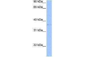 TREML2 antibody used at 1 ug/ml to detect target protein. (TREML2 anticorps  (Middle Region))