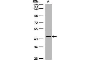 WB Image Sample(30 ug whole cell lysate) A:H1299 10% SDS PAGE antibody diluted at 1:1000 (ZNF134 anticorps)