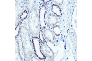 Western blot analysis of extracts of various cell lines, using ATPB antibody (ABIN7265722) at 1:153000 dilution.