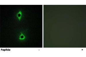 Immunofluorescence analysis of COS-7 cells, using PIKFYVE polyclonal antibody . (PIKFYVE anticorps)