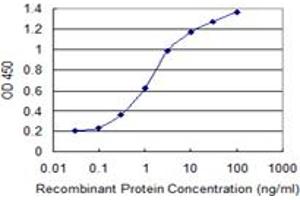 Detection limit for recombinant GST tagged SOX9 is 0. (SOX9 anticorps  (AA 400-509))