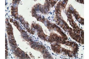 Image no. 3 for anti-Hydroxyprostaglandin Dehydrogenase 15-(NAD) (HPGD) antibody (ABIN1496361) (HPGD anticorps)