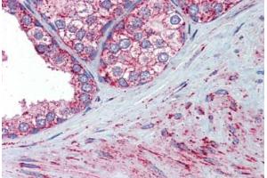 Prostate, Human: Formalin-Fixed, Paraffin-Embedded (FFPE)