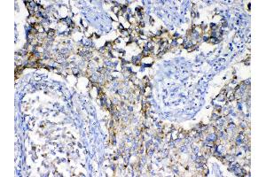 IHC analysis of SCF using anti-SCF antibody .