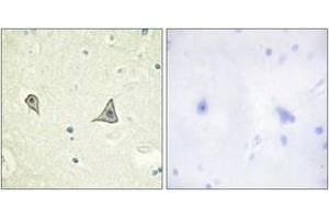 Immunohistochemistry analysis of paraffin-embedded human brain tissue, using M-CSF Receptor (Ab-723) Antibody. (CSF1R anticorps  (AA 691-740))