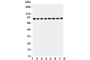 Western blot testing of Factor VIII antbody; Lane 1: A431;  2: HeLa;  3: SMMC-7721;  4: Jurkat;  5: Raji;  6: CEM;  7: HL-60;  8: MCF-7 cell lysate (Factor VIII anticorps  (Middle Region))