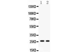 Anti- Picoband antibody, PB, Western blotting All lanes: Anti Kallikrein 4  at 0.