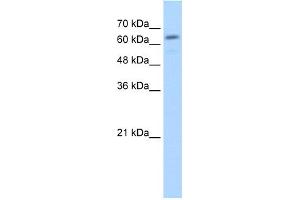WB Suggested Anti-GUSB Antibody Titration:  2. (Glucuronidase beta anticorps  (C-Term))