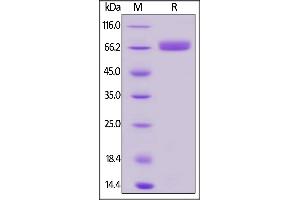Biotinylated Human CD200, Fc,Avitag on  under reducing (R) condition.