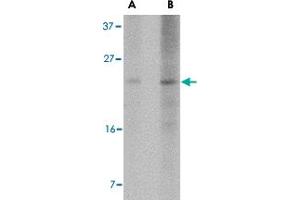 Western blot analysis of BBC3 expression in K-562 cell lysate with BBC3 monoclonal antibody, clone 2A8F6  at (A) 2.