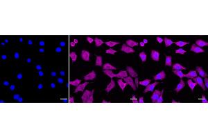 Immunocytochemical staining of C2C12 cells with Galectin 1 antibody (ABIN7799243), 1:1,000). (Recombinant LGALS1/Galectin 1 anticorps)
