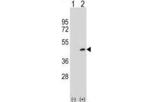 Western Blotting (WB) image for anti-Protein Arginine Methyltransferase 6 (PRMT6) antibody (ABIN2995520)