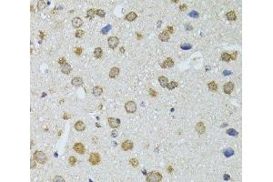 Immunohistochemistry of paraffin-embedded Mouse brain using RNASEL Polyclonal Antibody at dilution of 1:100 (40x lens). (RNASEL anticorps)