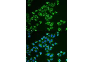 Immunofluorescence analysis of HeLa cells using TAGLN antibody. (Transgelin anticorps  (AA 1-201))