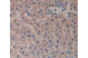 IHC-P analysis of Rat Tissue, with DAB staining. (SLIT3 anticorps  (AA 453-516))