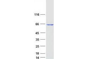 Validation with Western Blot