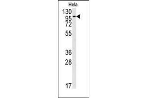 Western blot analysis of anti-FGFR2 Antibody (N-term) in Hela cell line lysates (35ug/lane). (FGFR2 anticorps  (N-Term))