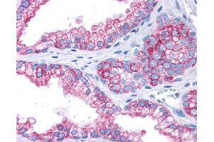 Anti-EPB41L2 antibody IHC of human prostate. (EPB41L2 anticorps  (AA 481-530))