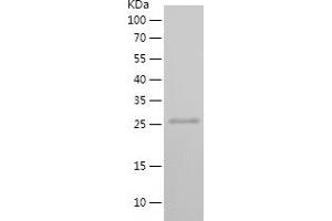 Western Blotting (WB) image for STT3, Subunit of The Oligosaccharyltransferase Complex, Homolog B (STT3B) (AA 480-541) protein (His-IF2DI Tag) (ABIN7125222)