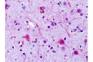 Anti-GPR75 antibody IHC of human brain, cortex, neurons. (GPR75 anticorps  (Cytoplasmic Domain))