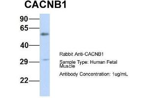 Host:  Rabbit  Target Name:  CACNB1  Sample Type:  Human Fetal Muscle  Antibody Dilution:  1. (CACNB1 anticorps  (Middle Region))