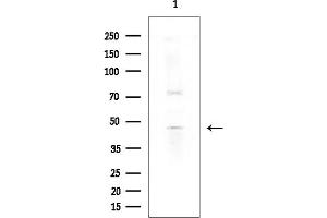Western blot analysis of lysates from COLO205 cells(heat-shock treatment), using CYP3 Antibody at 1/1000 dilution.