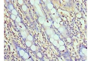 Immunohistochemistry of paraffin-embedded human colon tissue using ABIN7161654 at dilution of 1:100 (NLRC4 anticorps  (AA 1-250))