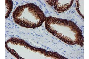 Image no. 8 for anti-Signal Recognition Particle Receptor, B Subunit (SRPRB) antibody (ABIN1501126)