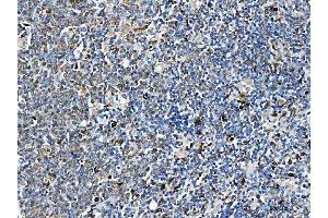 IHC analysis of ARHGAP45 using anti-ARHGAP45 antibody (ABIN7599740).