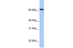 WB Suggested Anti-CCIN Antibody Titration: 0. (Calicin anticorps  (C-Term))