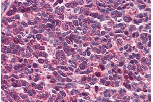 Human Tonsil: Formalin-Fixed, Paraffin-Embedded (FFPE)