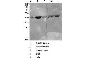 Western Blot (WB) analysis of specific cells using Antibody diluted at 1:1000. (CD72 anticorps)