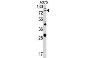 Image no. 1 for anti-Annexin A1 (ANXA1) (Middle Region) antibody (ABIN452740) (Annexin a1 anticorps  (Middle Region))