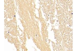 Detection of NSE in Human Cerebrum Tissue using Polyclonal Antibody to Enolase, Neuron Specific (NSE) (ENO2/NSE anticorps  (AA 1-434))