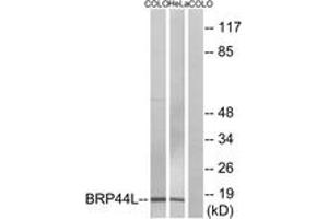 Western Blotting (WB) image for anti-Brain Protein 44-Like (BRP44L) (AA 11-60) antibody (ABIN2890168) (BRP44L anticorps  (AA 11-60))