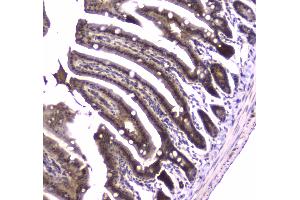 IHC analysis of Glutathione Reductase using anti-Glutathione Reductase antibody .