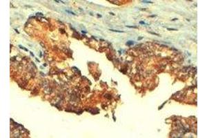 ABCC4 polyclonal antibody  (4 ug/mL) staining of paraffin embedded human prostate. (ABCC4 anticorps  (C-Term))