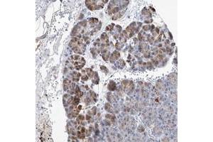 Immunohistochemical staining of human pancreas with SLC25A29 polyclonal antibody  shows moderate cytoplasmic positivity in exocrine glandular cells at 1:20-1:50 dilution. (SLC25A29 anticorps)