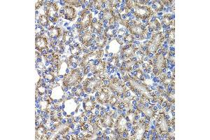 Immunohistochemistry of paraffin-embedded rat kidney using COPS2 antibody (ABIN5974233) at dilution of 1/100 (40x lens). (COPS2 anticorps)