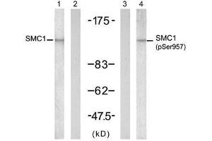 Western blot analysis of extract from K562 cells, untreated or treated with UV (20min), using SMC1 (Ab-957) antibody (E021190, Lane 1 and 2) and SMC1 (phospho-Ser957) antibody (E011198, Lane 3 and 4). (SMC1A anticorps  (pSer957))