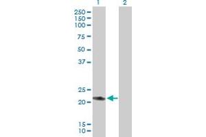 Western Blot analysis of RAB7L1 expression in transfected 293T cell line by RAB7L1 MaxPab polyclonal antibody.