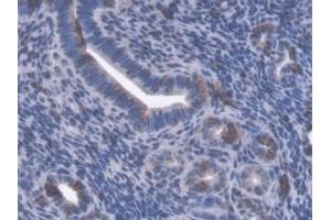 Detection of GBP4 in Mouse Uterus Tissue using Polyclonal Antibody to Guanylate Binding Protein 4 (GBP4)