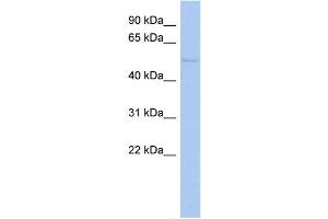 WB Suggested Anti-TIGD4 Antibody Titration: 0. (TIGD4 anticorps  (N-Term))