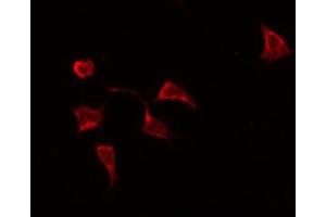 ABIN6269246 staining HeLa by IF/ICC. (STAT6 anticorps  (Internal Region))
