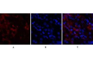 Immunofluorescence analysis of human stomach tissue. (CDK4 anticorps  (N-Term))