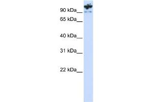 WB Suggested Anti-PCDHA6 Antibody Titration:  0. (PCDHA6 anticorps  (C-Term))