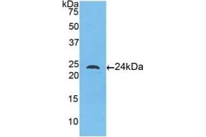 Western blot analysis of recombinant Human TLR5. (TLR5 anticorps  (AA 46-205))