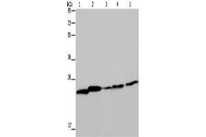 Western Blotting (WB) image for anti-rho GDP Dissociation Inhibitor (GDI) alpha (ARHGDIA) antibody (ABIN2423525) (ARHGDIA anticorps)